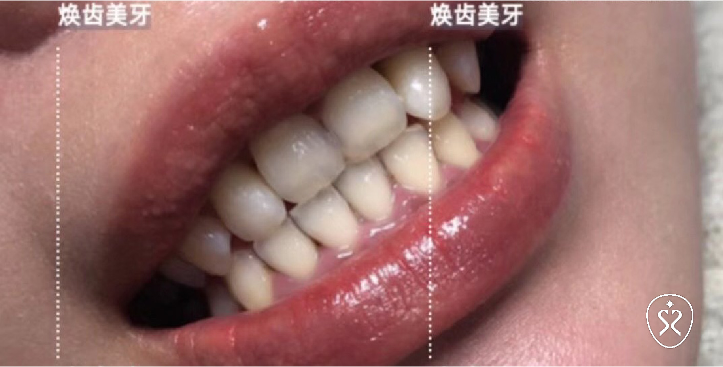 2018年的牙齒狀態